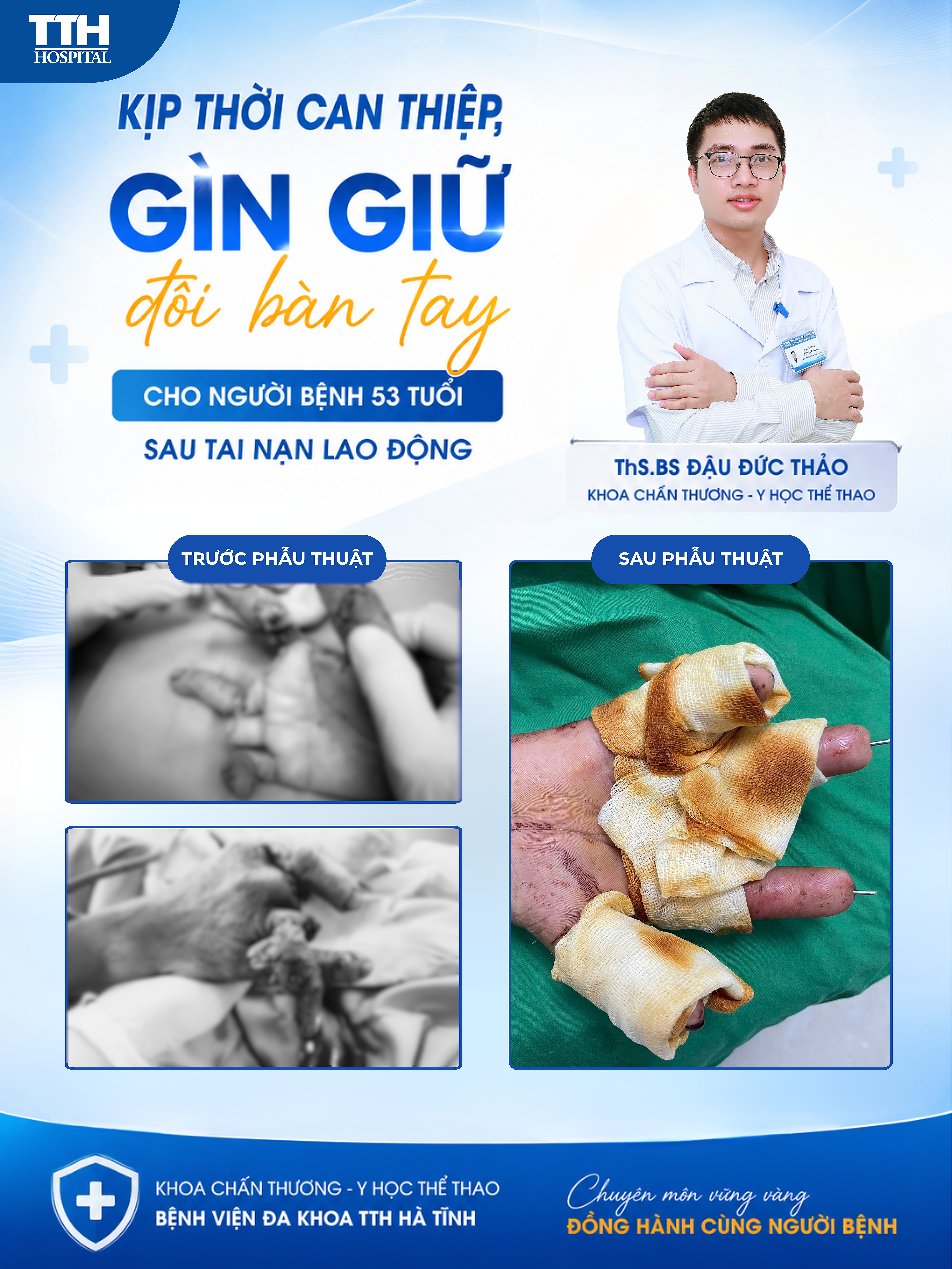 KỊP THỜI PHẪU THUẬT VI PHẪU, NỖ LỰC BẢO TỒN BÀN TAY SAU TAI NẠN MÁY CƯA